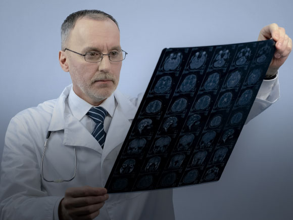 Traumatic Brain Injury ICD 10: Symptoms, Diagnosis, and Treatment