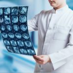 brain injury, brain scans, ct scan, TBI, traumatic brain injury