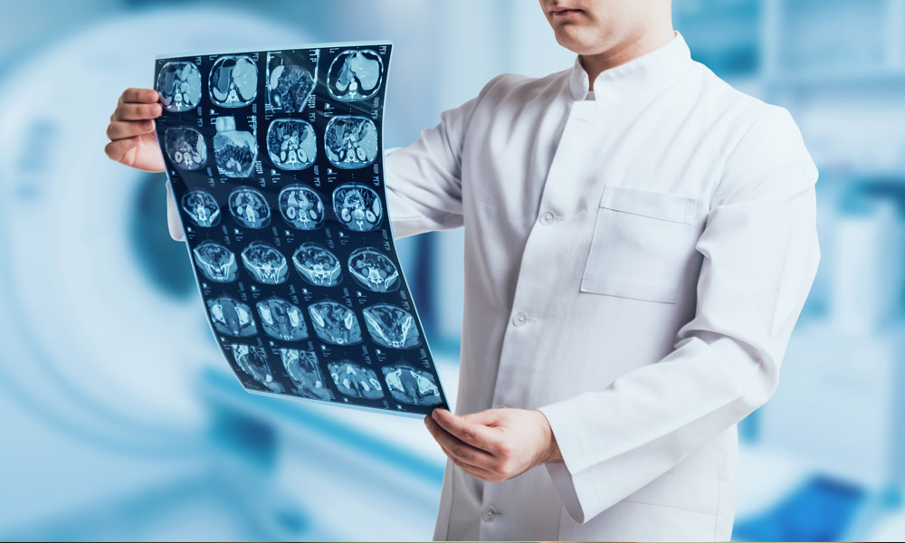 Scans And Tests After Traumatic Brain Injury