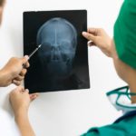 head injury in adults, brain injury, ct scan, MRI, traumatic brain injury