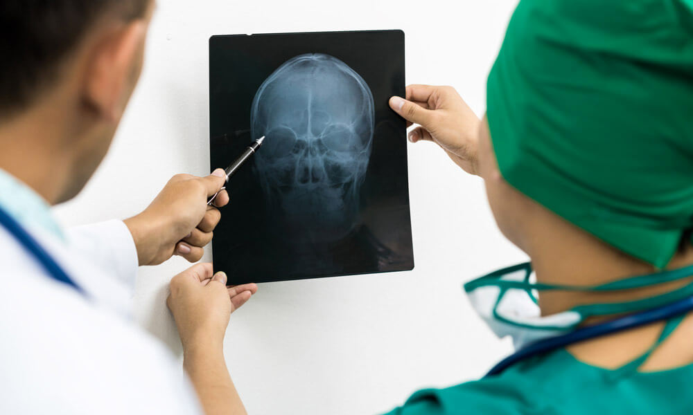 head injury in adults, brain injury, ct scan, MRI, traumatic brain injury