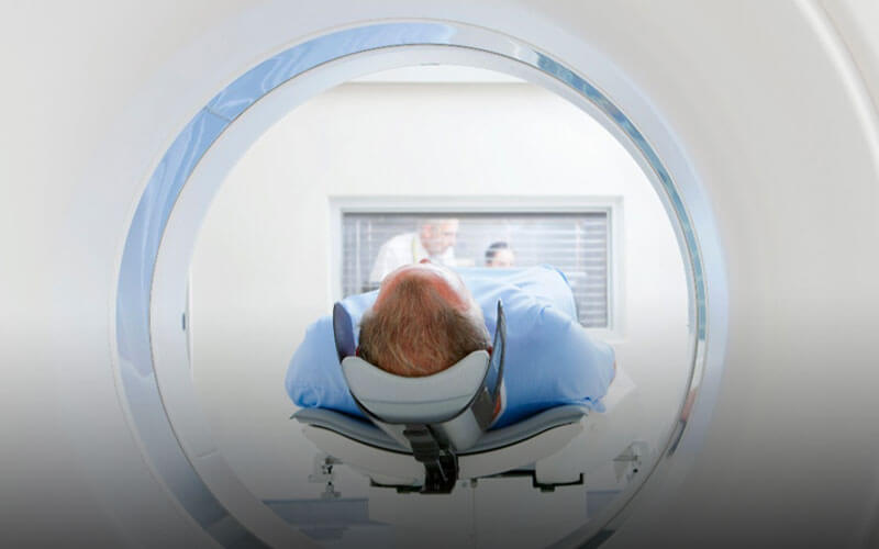 Traumatic Brain Injury Statistics