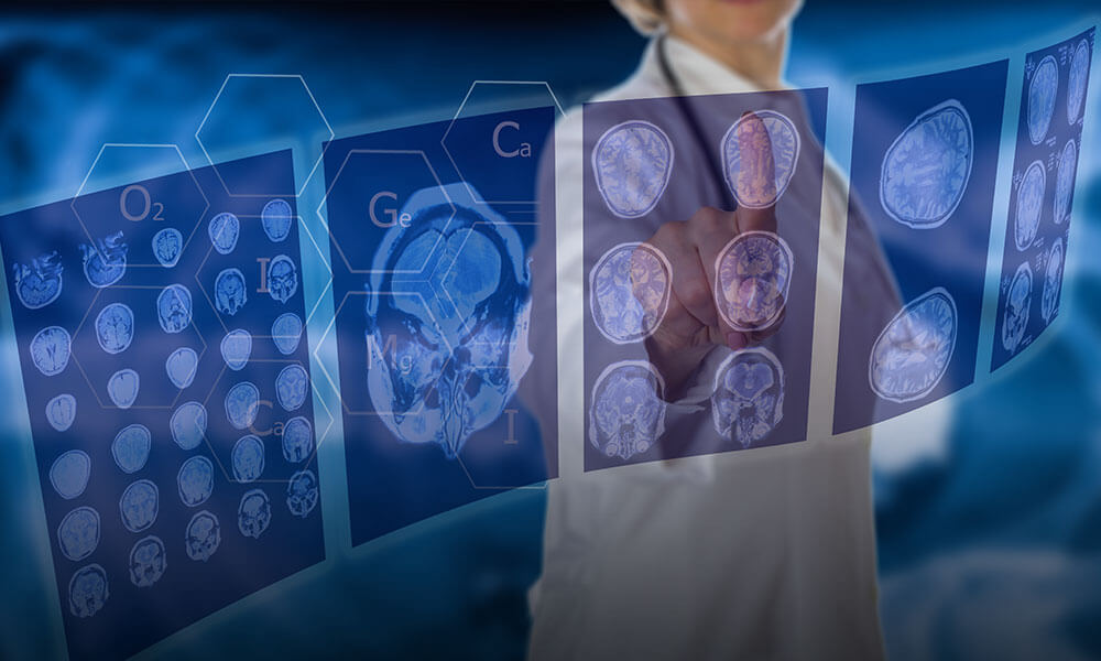 Spinal Cord Injury Symptoms