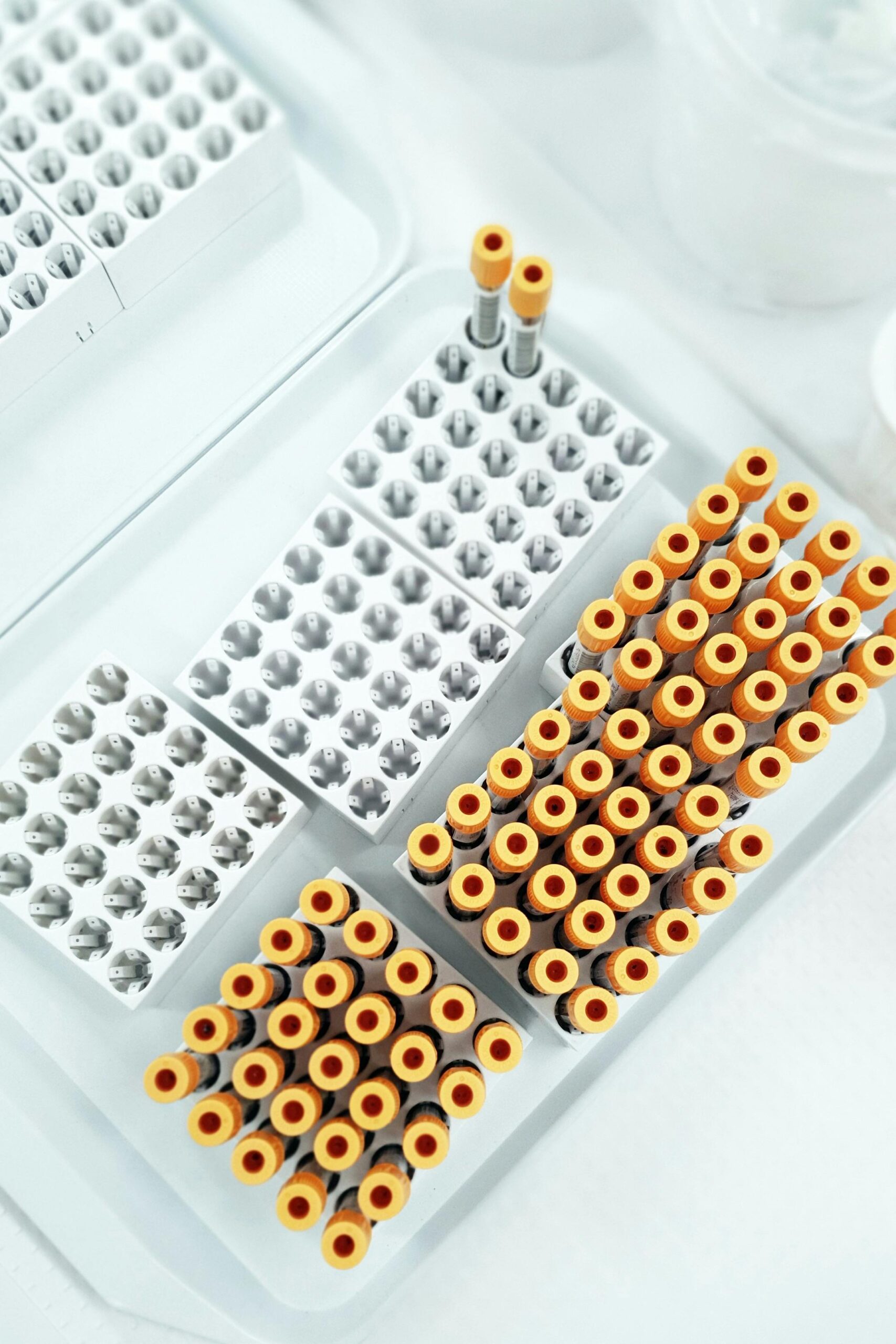 Neurofilament light biomarkers